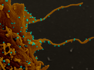 Newsweek: Коронавірус змушує клітини відрощувати 